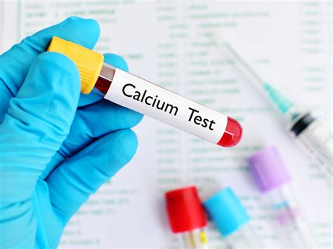 calcium blood test bottle colour|blood test for calcium levels.